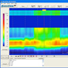 High Resolution Oesophagusmanometrie