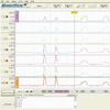 High Resolution Oesophagusmanometrie